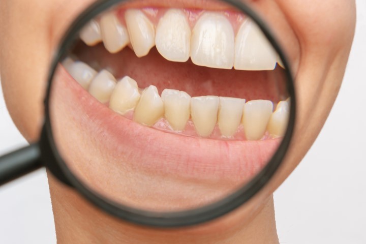 Understanding Dental Emergencies and How to Handle Them