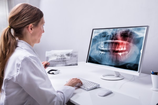 Shedding Light on Troublesome Wisdom Teeth
